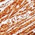 Human leiomyosarcoma stained with anti-Actin antibody
