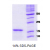 Alpha-Synuclein / SNCA