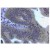 Immunohistochemistry (Paraffin-Embedded Sections): Human colon carcinoma tissue stained with AM08199PU-N at 5 µg/ml.