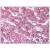 Liver: Formalin-Fixed Paraffin-Embedded (FFPE)