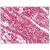 Adrenal: Formalin-Fixed Paraffin-Embedded (FFPE)