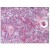 Thymus: Formalin-Fixed Paraffin-Embedded (FFPE)