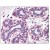 Breast: Formalin-Fixed Paraffin Embedded (FFPE)