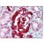 Kidney: Formalin-Fixed Paraffin-Embedded (FFPE)