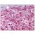 Adrenal: Formalin-Fixed Paraffin-Embedded (FFPE)
