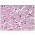 Heart: Formalin-Fixed Paraffin-Embedded (FFPE)