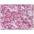 Adrenal: Formalin-Fixed Paraffin-Embedded (FFPE)