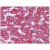 Liver: Formalin-Fixed Paraffin-Embedded (FFPE)