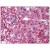 Adrenal: Formalin-Fixed Paraffin-Embedded (FFPE)