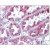 Kidney: Formalin-Fixed Paraffin-Embedded (FFPE)
