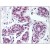 Breast: Formalin-Fixed Paraffin-Embedded (FFPE)