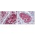 Figure 1. AP08774PU-N S100A4 antibody staining of Formalin-Fixed, Paraffin-Embedded Human Uterus, vessel (Right) and Human Small intestine (Left).