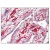 AP08793PU-N AIF1 antibody staining of Formalin-Fixed Paraffin-Embedded Human Placenta tissue at 2.5 µg/ml.