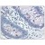Colon: Formalin-Fixed Paraffin-Embedded (FFPE)