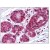 Breast: Formalin-Fixed Paraffin-Embedded (FFPE)