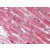 Immunohistochemistry: AP08857PU-N S100A4 antibody staining of Formalin-Fixed Paraffin-Embedded Human Heart at 2.5 µg/ml followed by biotinylated goat anti-rabbit IgG secondary antibody, alkaline phosphatase-streptavidin and chromogen.