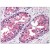Immunohistochemistry analysis of Formalin-Fixed Paraffin-Embedded Human Prostate tissue, using AM08335PU-N at 5 µg/ml