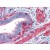 Uterus: Formalin-Fixed, Paraffin-Embedded (FFPE)