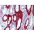 Human Kidney (formalin-fixed, paraffin-embedded) stained with KRT19 this antibody at 10 µg/ml followed by biotinylated anti-mouse IgG secondary antibody, alkaline phosphatase-streptavidin and chromogen.