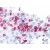 Tonsil, neutrophils: Formalin-Fixed, Paraffin-Embedded (FFPE)