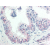 Immunohistochemistry using Anti-AKT pS473 monoclonal antibody Cat.-No AM08432PU-N shows detection of phosphory-lated AKT pS473 in human prostate tissue. The antibody was used at 20 μg/ml. The staining is much stronger than the weak basal level of phosphorylation in normal prostate tissue. Tissue was formalin fixed and paraffin embedded. No pre-treatment of sample was required. Signal was developed using streptavidin-biotin reagents. Personal communication, Glenna Burmer, Lifespan Biosciences, Seattle, WA.