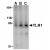 Figure 1. Western blot: AP09159PU-N CD281/TLR1 antibody staining of Mouse spleen tissue whole cell lysate. This IgG fraction of anti-TLR1 antibody shows detection of a predominant band at ~90 kDa corresponding to TLR1 (arrowhead). The predicted MW of TLR1 is 90 kDa. TLR1 was detected using 1.0 µg/ml (lane A, 2.0 µg/ml (lane B) and 4.0 µg/ml (lane C) concentrations of primary antibody.