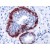 Human prostate stained with anti-keratin 6 antibody