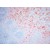 Figure.1: AEC staining of Paraffin Sections of Human tonsills with Mouse Anti Human Prolyl-4-Hydroxylase beta (Fibroblast marker) clone 3-2B12. Cat.-No. AF0910-1