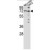Western blot analysis of ZYX Antibody (C-term) (AP17858PU-N) in NCI-H460, T47D cell line lysates (35ug/lane). ZYX (arrow) was detected using the purified Pab.