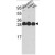 Western blot analysis of YWHAQ Antibody (N-term) (AP17850PU-N) in MDA-MB231,Y79 cell line and mouse brain tissue lysates (35ug/lane). YWHAQ (arrow) was detected using the purified Pab.(2ug/ml)