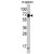 Western blot analysis of KRT4 antibody (C-term) (AP17531PU-N) in mouse spleen tissue lysates (35ug/lane). KRT4 (arrow) was detected using the purified Pab.
