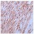 Leiomyoma stained with Anti-beta Actin Antibody