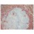 BM4025 S100A8/9 antibody staining of Human Tonsil Frozen Section.