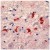 AP15743PU Presenilin 1 antibody staining of Human Brain.
