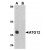 Western blot. AP20048PU-N ATG12 antibody staining of Mouse heart tissue lysate at 1 µg/ml.
A: Absence of Blocking peptide
B: Presence of Blocking peptide