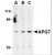 Western blot analysis of ATG7 in Caco-2 cell lysate with ATG7 Antibody Cat.-N AP20055PU-N at (A) 0.5, (B) 1 and (C) 2 μg/ml.