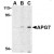AP20056PU-N ATG7 antibody staining of L1210 cell lysate by Western Blotting at (A) 1, (B) 2 and (C) 4 μg/ml.
