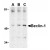 AP20057PU-N Beclin-1 antibody staining of A431 cell lysate by Western Blotting at (A) 0.5, (B) 1 and (C) 2 μg/ml.