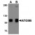 AP20065PU-N ATG9B antibody staining of HeLa Cell Lysate by Western Blotting at (A) 1 and (B) 2 µg/ml