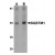 AP20066PU-N SQSTM1 antibody staining of Human Spleen Tissue Lysate by Western Blotting at (A) 1 and (B) 2 μg/ml.