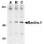 Western blot analysis of Beclin-1 in A431 cell lysate with AP30134PU-N Beclin-1 antibody at (A) 0.5, (B) 1 and (C) 2 μg/ml.