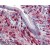 AP16925PU-N S100A4 Antibody staining of Paraffin Embedded Human Small Intestine at 2.5 µg/ml. Steamed antigen retrieval with citrate buffer pH 6, AP-staining.