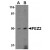Western blot analysis of FEZ2 in mouse brain tissue lysate with AP30334PU-N FEZ2 antibody at (A) 0.5, and (B) 1 μg/ml.