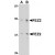 Western blot analysis of FEZ2 in 3T3 cell lysate with AP30335PU-N FEZ2 antibody at (A) 0.5, and (B) 1 μg/ml.