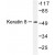 Western blot(WB) analysis of Keratin 8 antibody in extracts from HeLa treated with Anisomycin 25ug/ml 30'