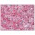 R1035P APOC3 antibody staining of Formalin-Fixed, Paraffin-Embedded Human Liver followed by biotinylated anti-Goat IgG secondary antibody, Alkaline Phosphatase-Streptavidin and Chromogen.