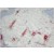 BP4011 S100A8/A9 antibody staining of Human Skin Frozen Section.