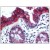 BM2275F KRT18 antibody staining of Formalin-Fixed, Paraffin-Embedded Human Colon followed by biotinylated anti-mouse IgG secondary antibody, alkaline phosphatase-streptavidin and chromogen.
