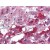 Adrenal, Human: Formalin-Fixed, Paraffin-Embedded (FFPE)
