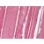 Human Skeletal Muscle (formalin-fixed, paraffin-embedded) stained with FEZ2 antibody AP22606PU-N at 3 µg/ml followed by biotinylated goat anti-rabbit IgG secondary antibody, alkaline phosphatase-streptavidin and chromogen.